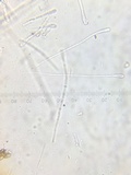 Humaria hemisphaerica image