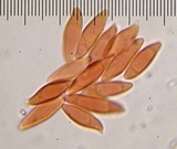 Lepiota magnispora image