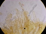 Lepiota magnispora image