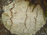 Pertusaria amara f. amara image