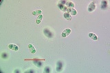 Caloplaca stanfordensis image