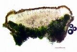 Caloplaca bolacina image