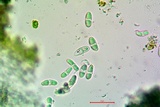 Caloplaca bolacina image