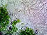 Caloplaca bolacina image