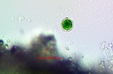 Caloplaca bolacina image