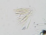 Lachnellula cervina image