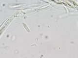 Lachnellula cervina image