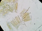 Lachnellula cervina image