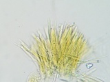 Lachnellula cervina image