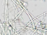 Lachnellula cervina image