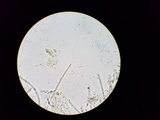 Lachnellula cervina image