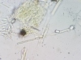 Lachnellula cervina image