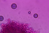 Pseudocraterellus calyculus image