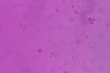 Pseudocraterellus calyculus image