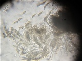 Rebentischia massalongii image