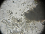 Rebentischia massalongii image