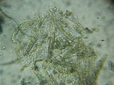 Rebentischia massalongii image