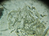Rebentischia massalongii image
