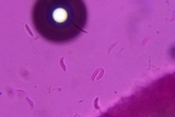 Eocronartium muscicola image