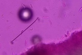 Eocronartium muscicola image