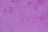 Eocronartium muscicola image