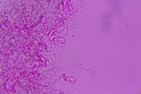 Eocronartium muscicola image