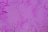 Eocronartium muscicola image