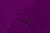Sebacina epigaea image