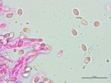 Cantharellus phasmatis image
