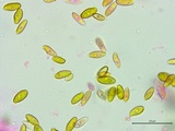 Boletus chrysenteron image