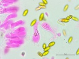 Boletus chrysenteron image