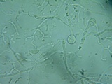 Myxarium nucleatum image