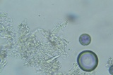 Peniophorella subpraetermissa image