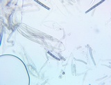Trichoglossum variabile image
