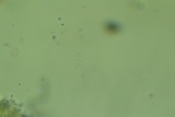 Cystodermella adnatifolia image