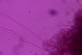 Thelephora scissilis image