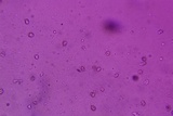 Thelephora scissilis image