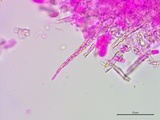 Subulicystidium brachysporum image
