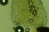 Mucronella subalpina image