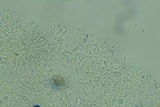 Mucronella subalpina image