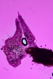 Mucronella subalpina image