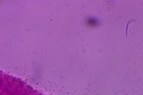 Mucronella subalpina image