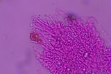 Mucronella subalpina image