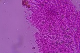 Mucronella subalpina image