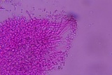 Mucronella subalpina image