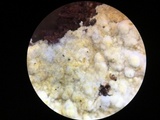 Mycolindtneria leucobryophila image