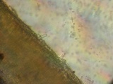 Cotylidia diaphana image