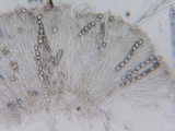Pachyella babingtonii image
