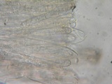 Pachyella babingtonii image