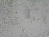 Pachyella babingtonii image